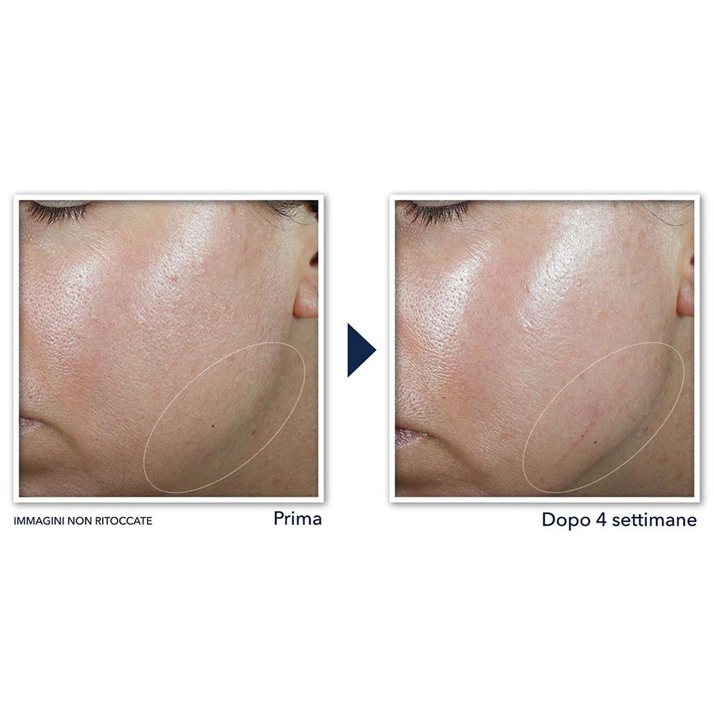 QVC RoC Crema viso Derm Correxion® ridefinisce e rassoda Saldi Di Fabbrica