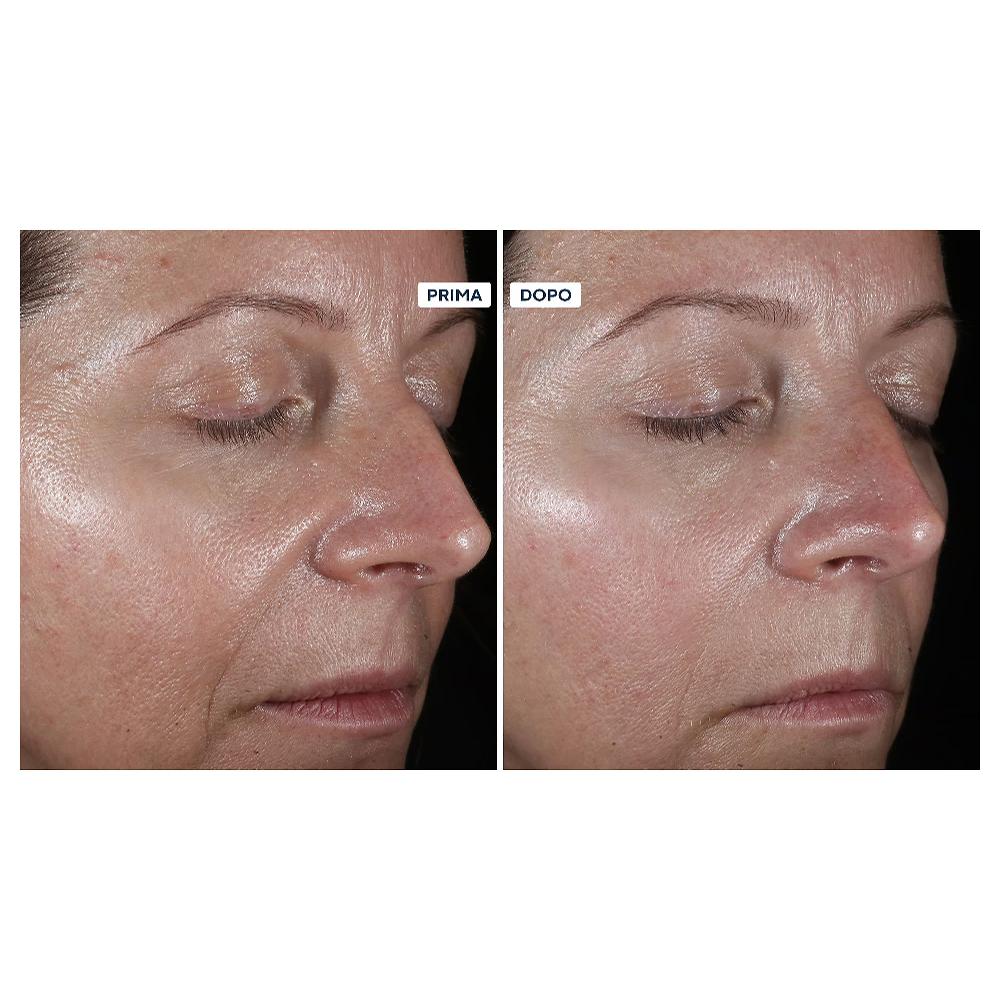 QVC Perricone MD Kit 4 prodotti viso: detergente idratante siero viso e occhi Saldi