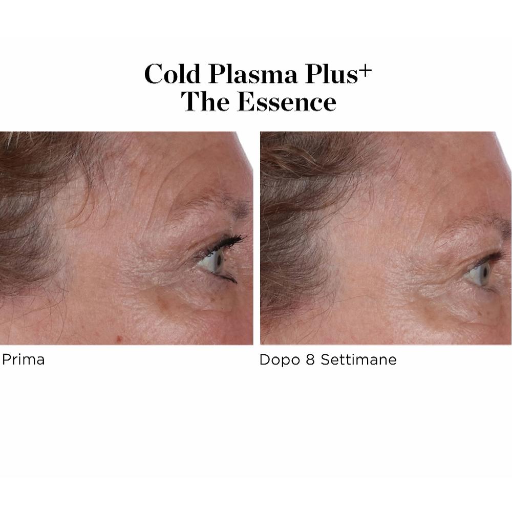 QVC Perricone MD Siero viso Cold Plasma Plus+ The Essence Lightning offer