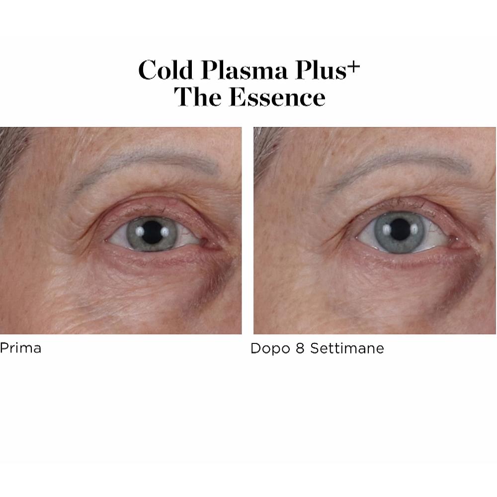 QVC Perricone MD Siero viso Cold Plasma Plus+ The Essence Lightning offer