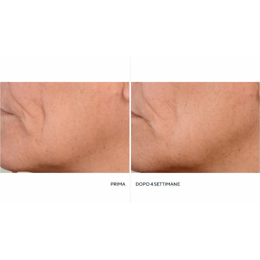 QVC Perricone MD Crema notte Essential FX + siero Firming&Lifting Latest fashion