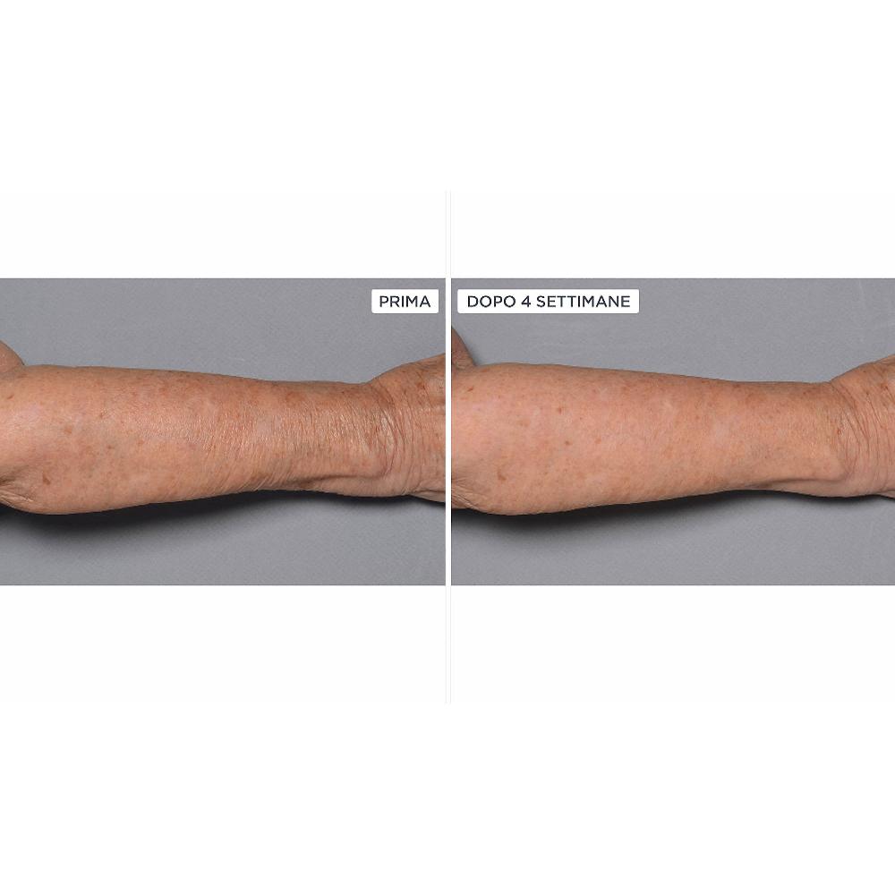 QVC Perricone MD Cold Plasma+Fragile Skin corpo 2pz Offerta natalizia