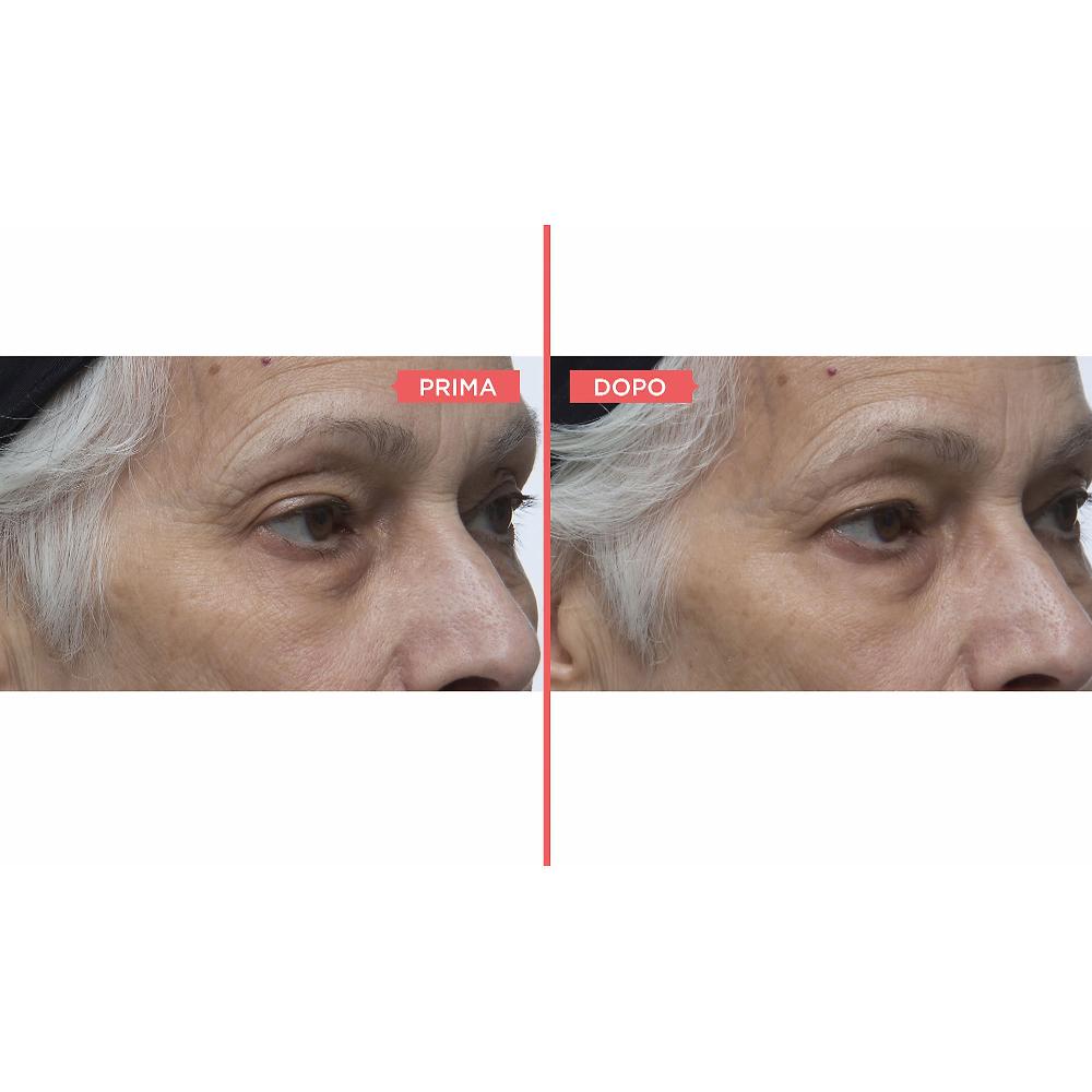 QVC Perricone MD Eyelid Serum Duo siero occhi antiossidante Italia