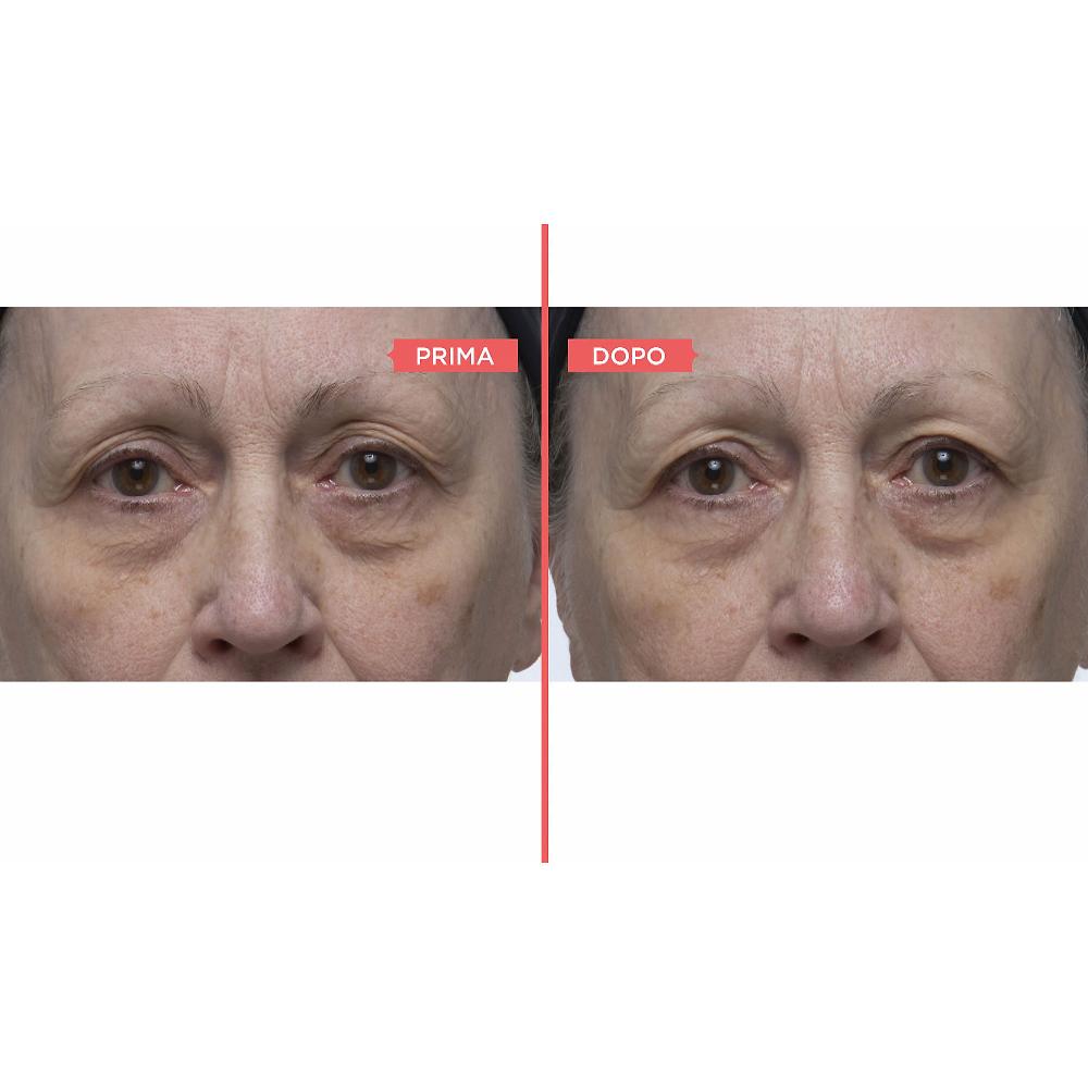 QVC Perricone MD Eyelid Serum Duo siero occhi antiossidante Italia