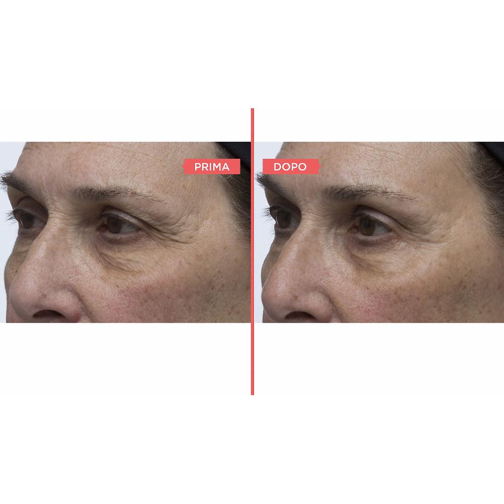 QVC Perricone MD Eyelid Serum Duo siero occhi antiossidante Italia